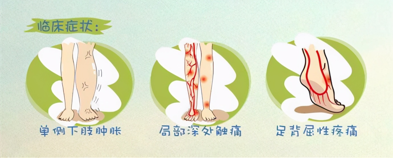 预防血栓最有效的方法阿司匹林,孕期预防血栓如何打肝素