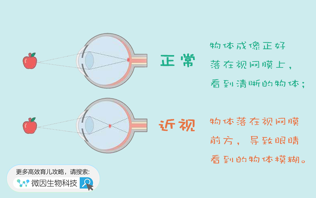 发现孩子近视了要立即配眼镜吗,发现孩子有点近视需要戴眼镜吗