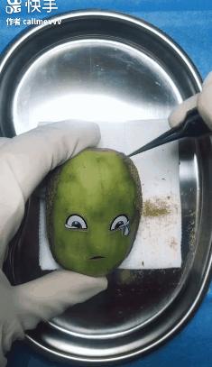 香蕉割包皮,洋葱剖腹产?这是我见过最秀的医生