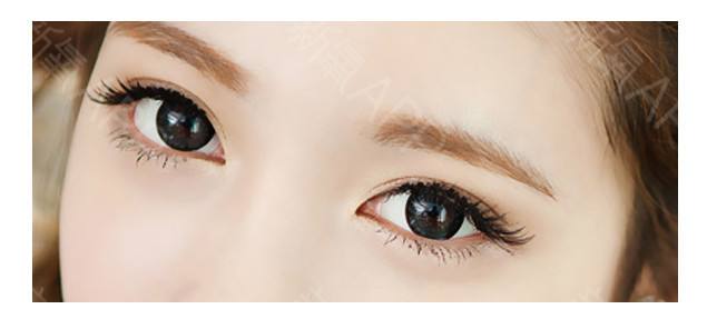 明显双眼皮注意事项,单双眼皮会变成恐怖的阴阳眼吗