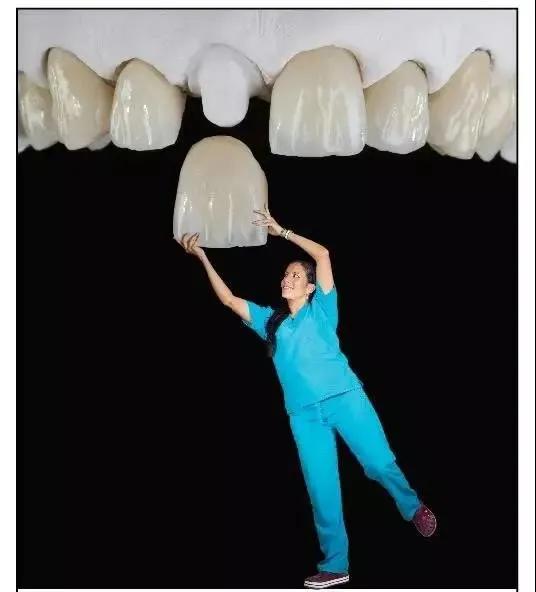 二氧化锆全瓷牙材料有哪些,二氧化锆烤瓷牙多少钱一颗