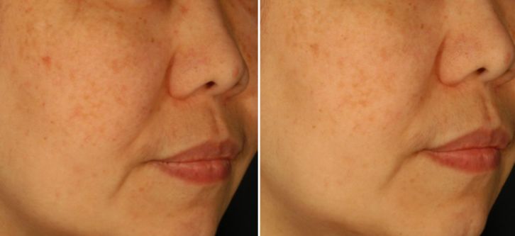 双11值得抢的有哪些,双11爆款预售清单