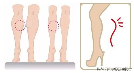 小腿粗怎么穿鞋子好看,适合小腿粗穿的裤子