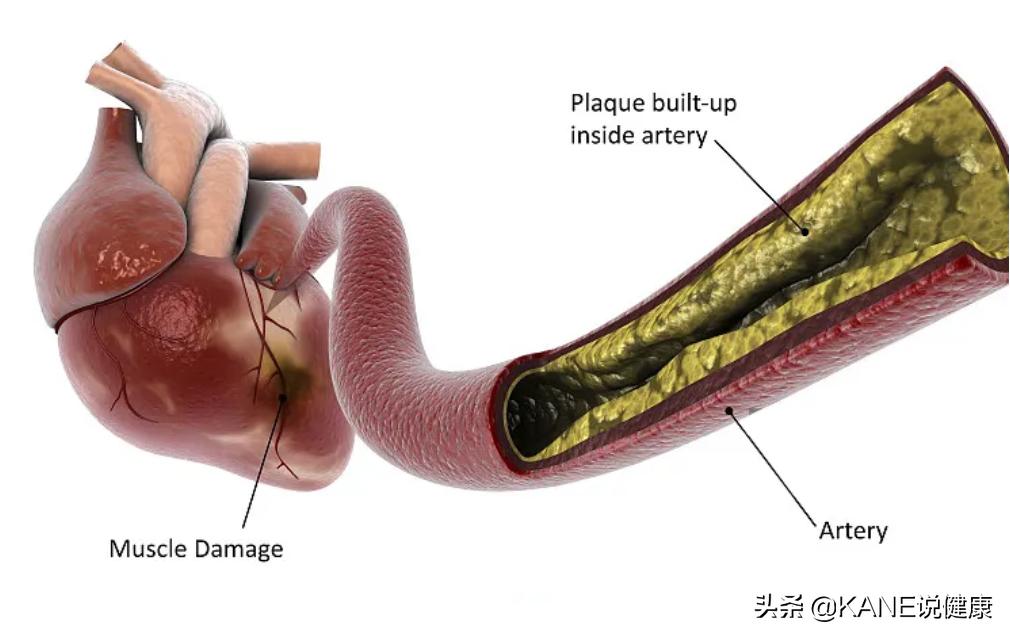 血液净化能控制血栓吗,血液净化真的能排油吗
