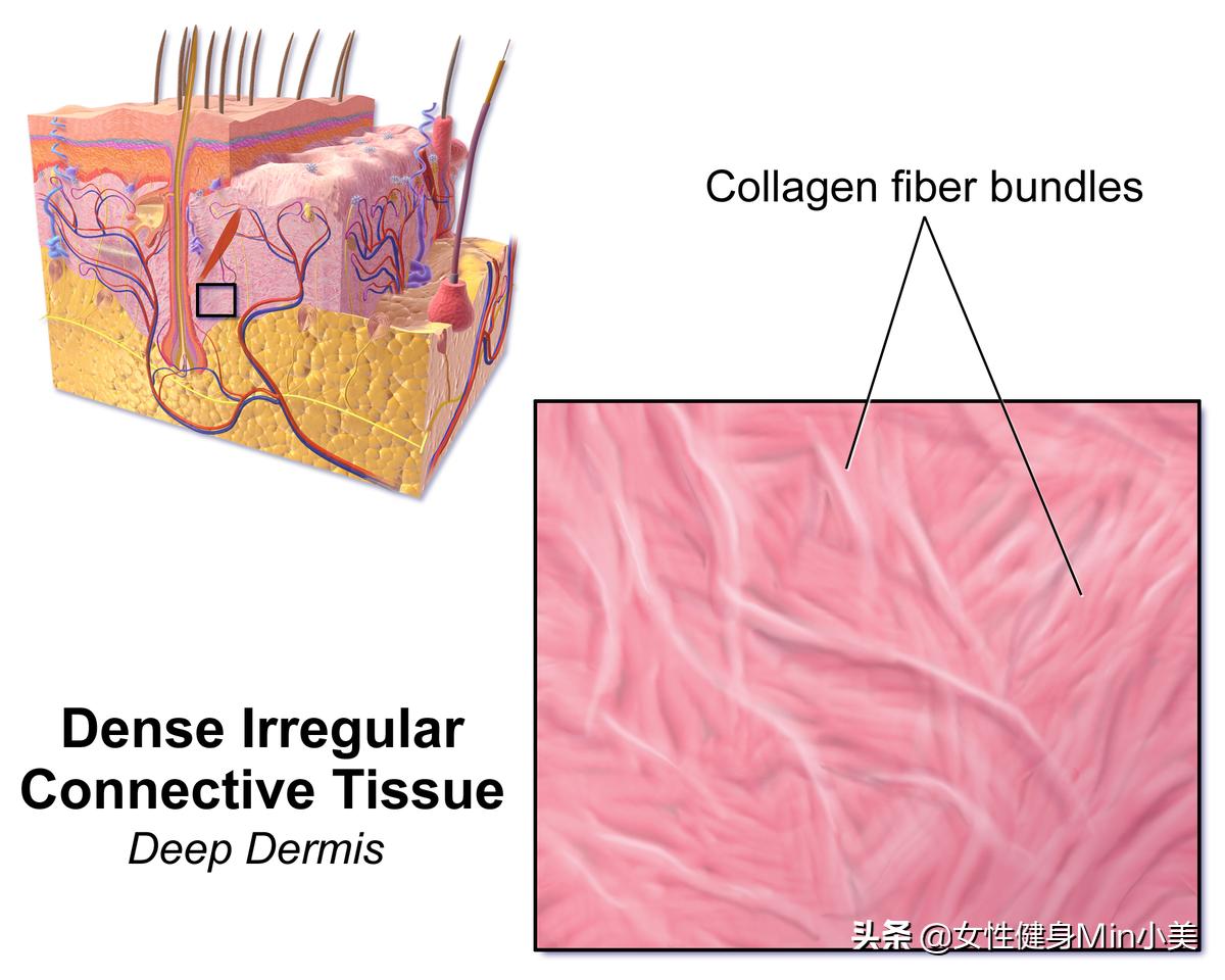 腿上的橘皮组织怎样锻炼,大腿后侧橘皮组织怎么消除