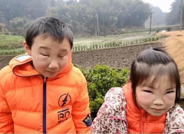 挺漂亮俩孩子，蜜蜂蜇得他妈都不认识了