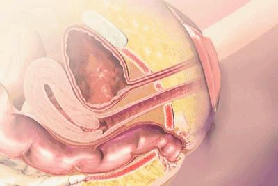 男人怕前列腺炎吗,男人怕前列腺炎女人怕什么