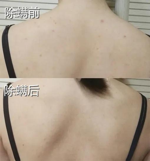 皮肤科医生都推荐的硫磺液体香皂,李佳琦5分钟卖了14406套