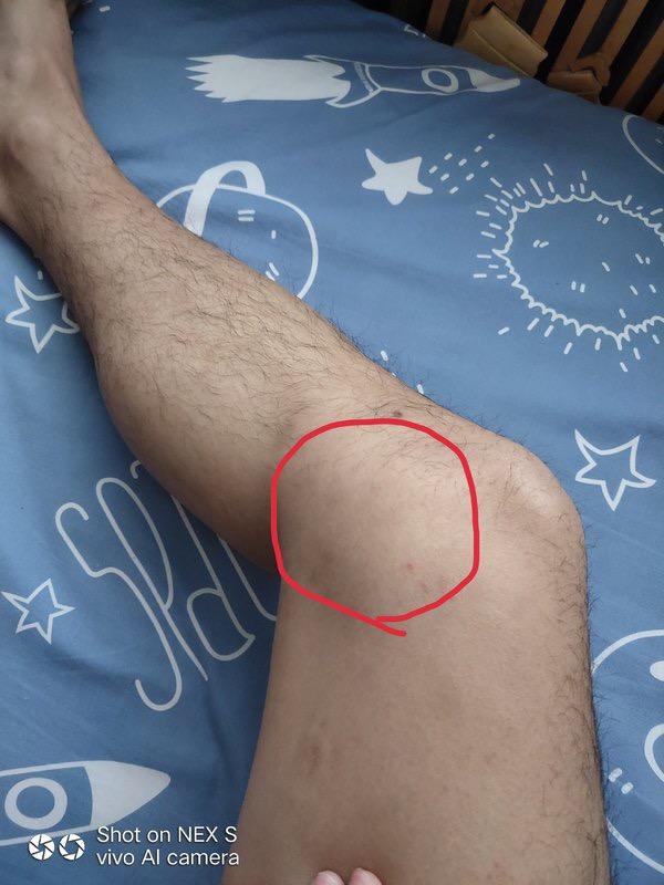 自觉心里不舒服是焦虑症吗,焦虑症总是自觉身体不适