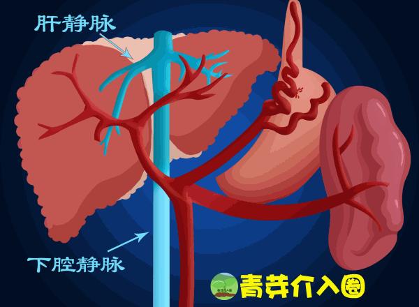 乙肝病人出现吐血便血大概活多久,乙肝吐血止血治疗方法