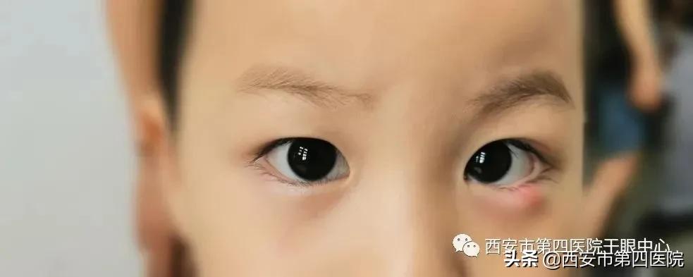 健康科普探访,健康科普浅析疾病复发