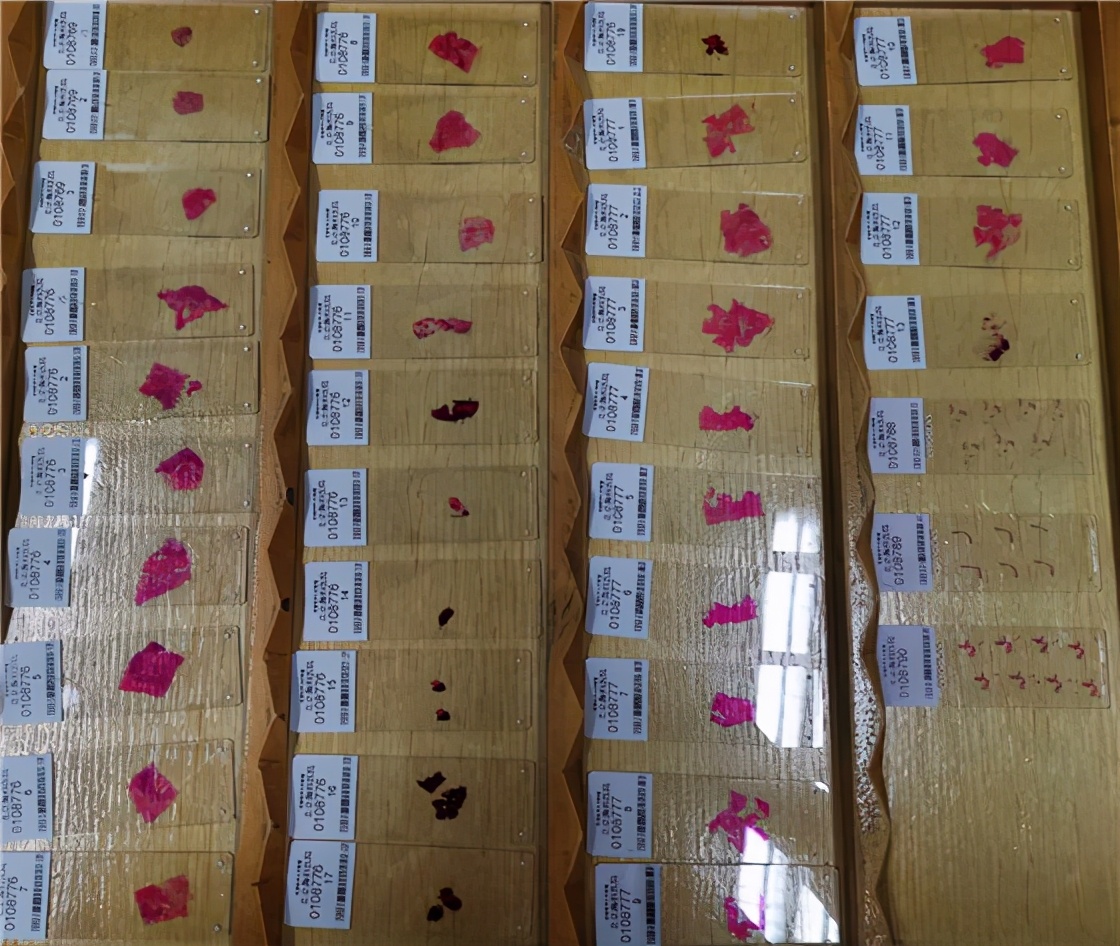 病理讲解视频全集,病理学讲解详细视频