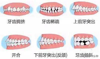 怎样预防龋齿拔牙,什么是蛀牙如何预防蛀牙