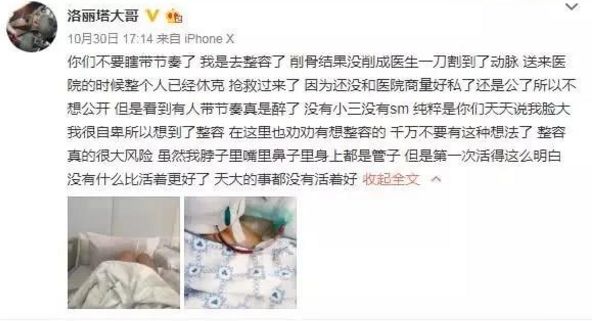 女主播洛丽塔大哥整容意外成整形医生反面教材：要安全变美