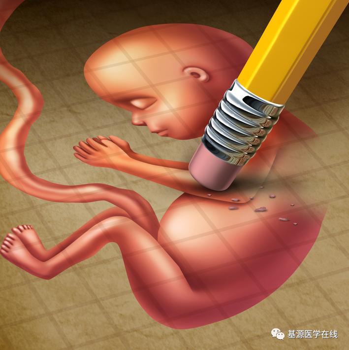 人流和药流应该如何选择,40岁怀孕了选择药流还是人流