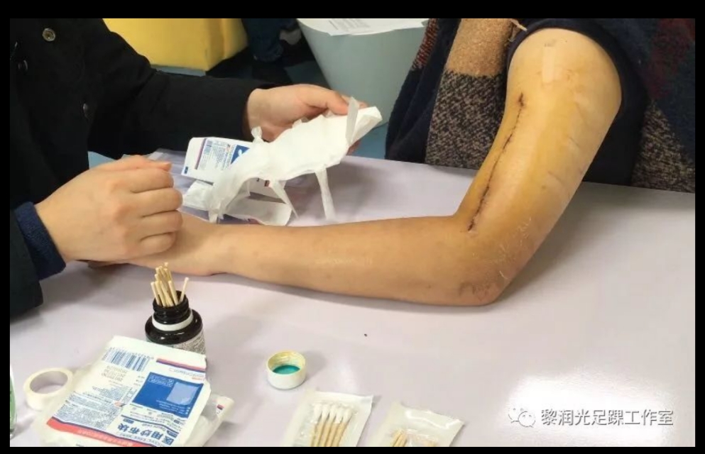 术后自己在家换药应该注意什么,医院手术后换药流程