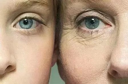 咨询有抬头纹法令纹鱼尾纹怎么办,去皱纹鱼尾纹法令纹抬头纹