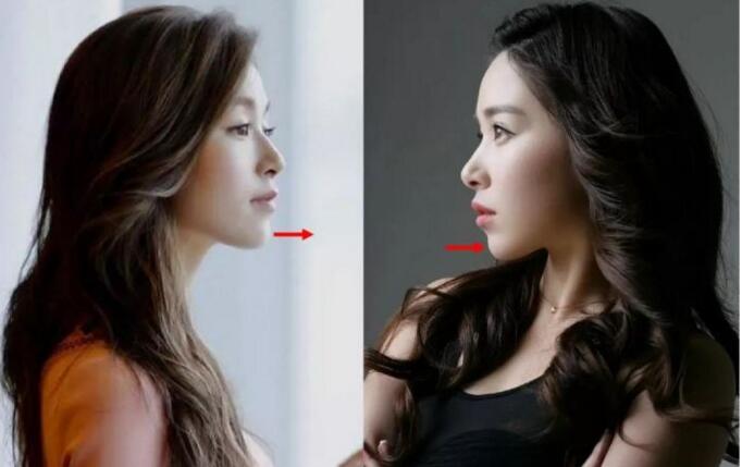 面部一枝花全靠鼻当家,论鼻子对颜值的重要性▼