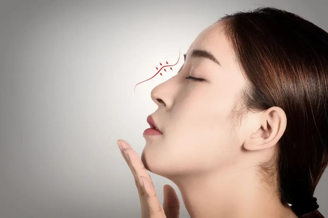 鼻头缩小手术真实案例,鼻头缩小手术风险大吗有后遗症吗