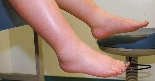 怀孕双胞胎6个月注意事项,5到6周孕妇的注意事项