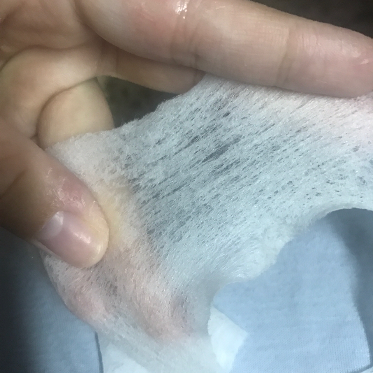 长痘痘怎么拯救痘印,长痘痘的肌肤怎么修复