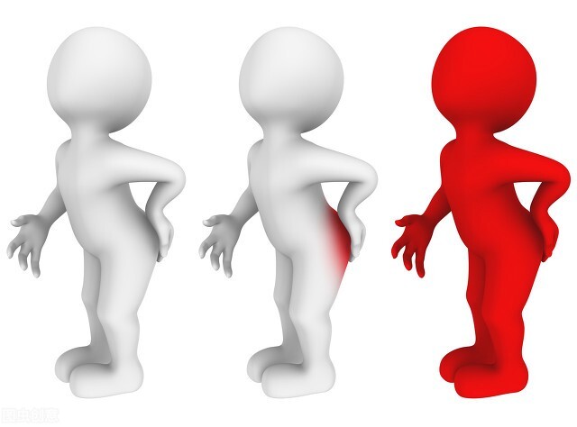 痔疮真的是可以轻松应对的,关于痔疮你还需要知道这几点