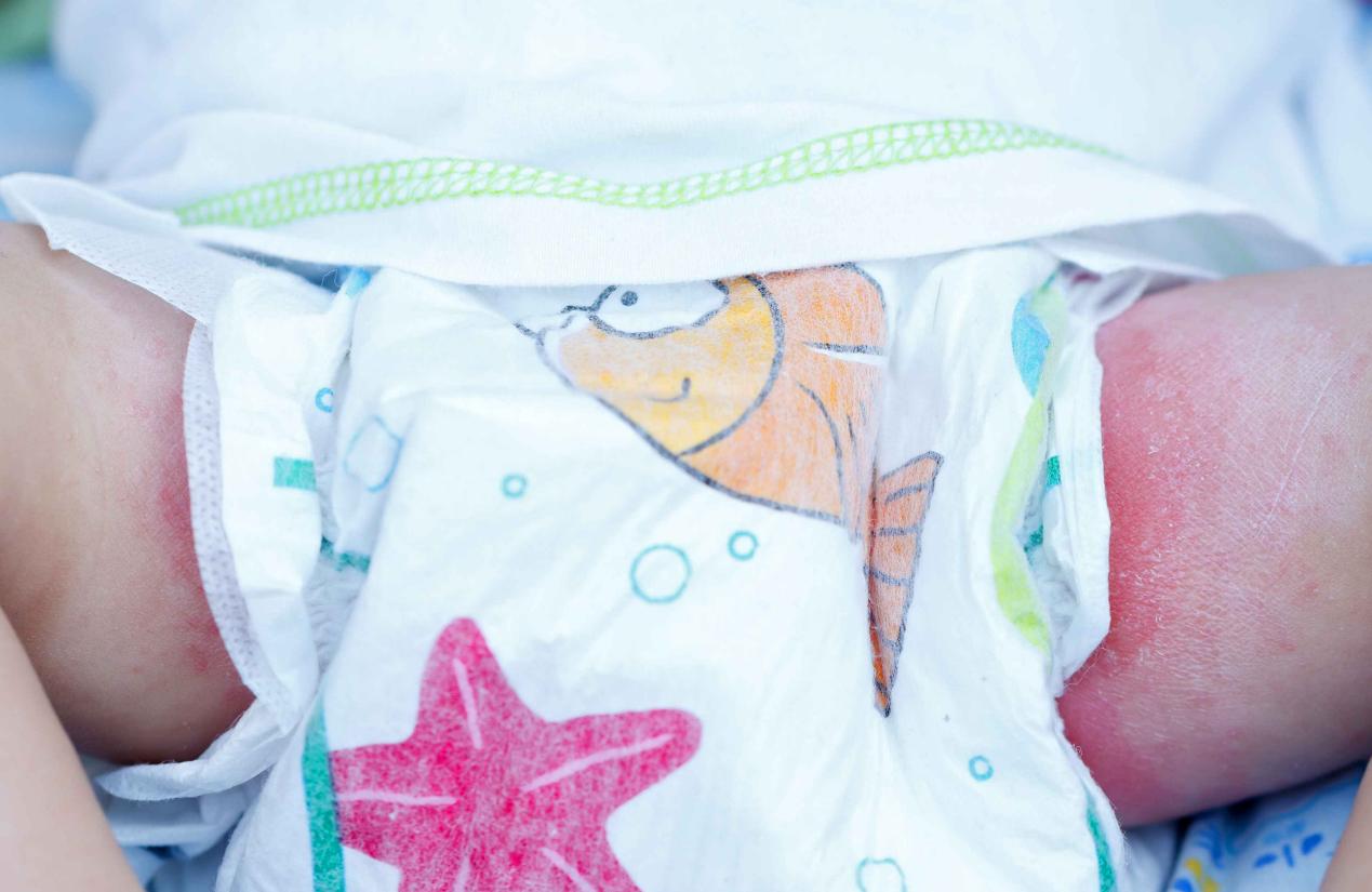 给孩子擦屁股用棉柔巾还是湿巾,给宝宝擦屁股用哪种湿巾