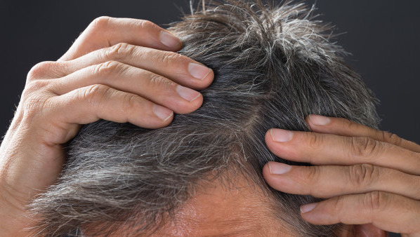 头发出油脱发看什么科,头发出油脱发怎么办好