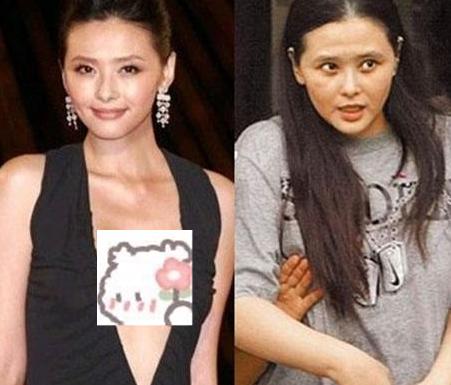 靠袒胸搏出位,3次吸毒被抓,如今患癌的她为保命切除5个器官