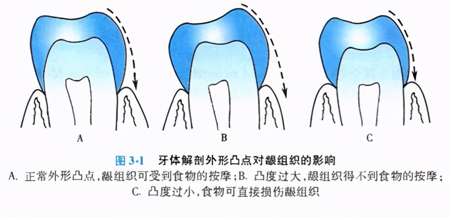 牙齿缺损修复去哪家牙科医院,牙科门牙缺损修复照片