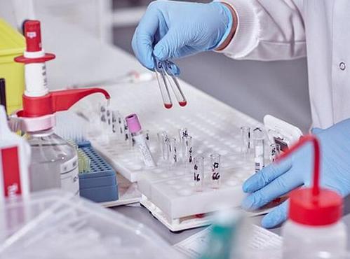 尿里有蛋白一个隐血一个是肾炎吗,仅尿蛋白1+能判断是肾炎吗