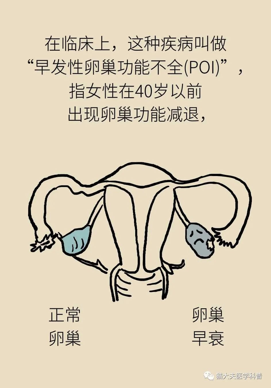 30岁例假就两月一次怎么办,30岁例假就特别少原因