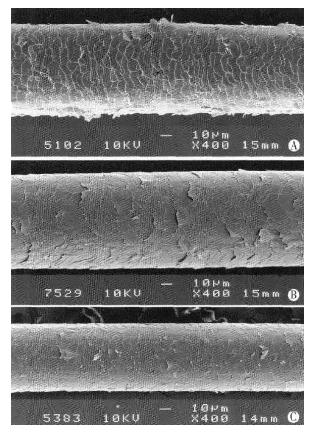 脱发与烫发染发有关吗,头发脱发了适合烫发和染发吗