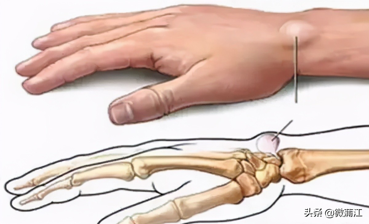 超声新技术医学影像,超声医学检查技术