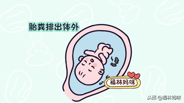 孕晚期羊水略浑浊怎么办,孕晚期什么情况会引起羊水浑浊