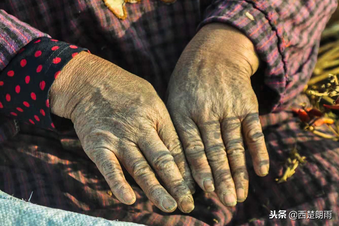 老人双手磨破捉虫想“救”血癌孙被儿子泪拒,跪求老天放过孩子