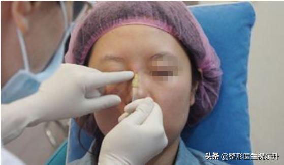 为什么打了玻尿酸还是没效果,打玻尿酸和不打十年以后区别