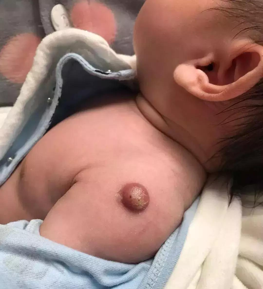 女子用假避孕套后染病：人心究竟能坏到什么程度？！