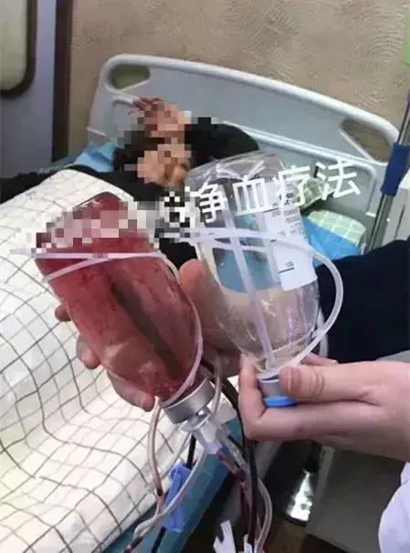 5万一次的血液净化能降血脂吗,健康人做血液净化好处多吗