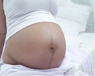 女性在怀孕后身体会发生什么变化,女性受孕后身体会发生哪些变化