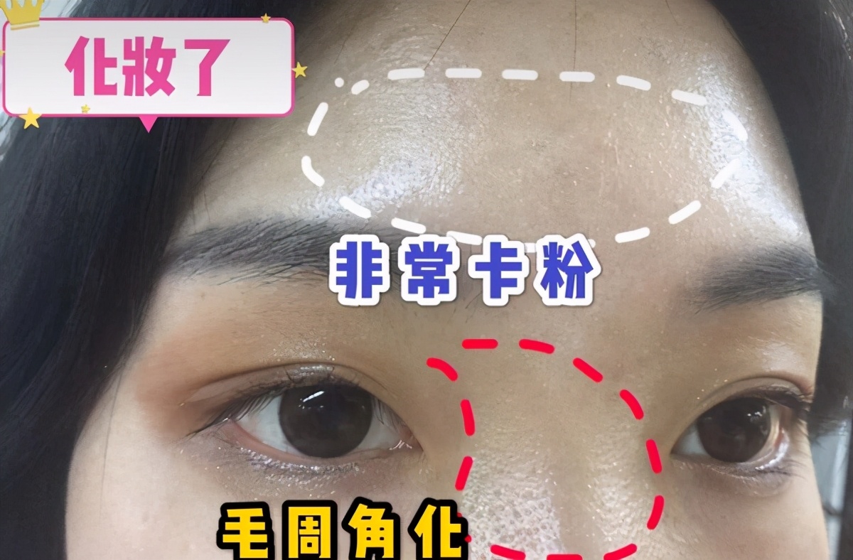 卡粉和浮粉的正确化妆方法,如何解决化妆卡粉的问题