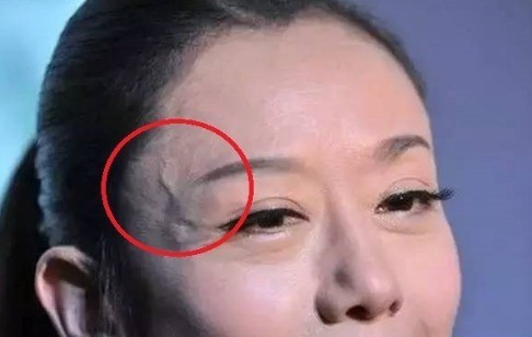 身上看到青筋什么原因,小腿能看见青筋正常吗