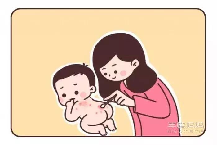 宝宝容易长痱子用什么爽身粉,宝宝长痱子怎么用炉甘石洗剂