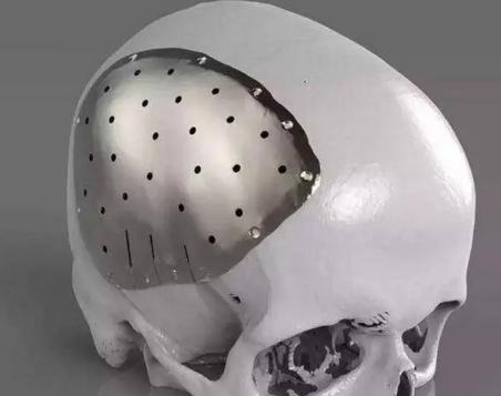 纯钛水壶是什么材质,纯钛合金水壶