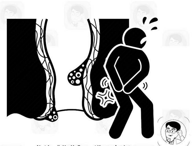 小心痔疮,日常生活该如何预防痔疮疾病