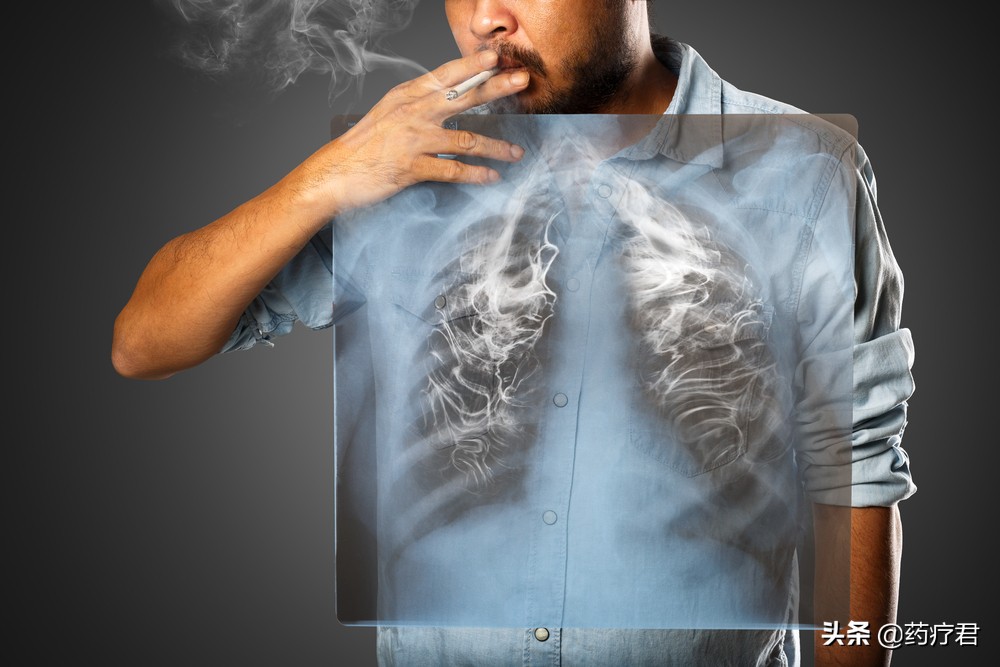 决定戒烟了，是直接一根不吸好，还是慢慢地减少好？