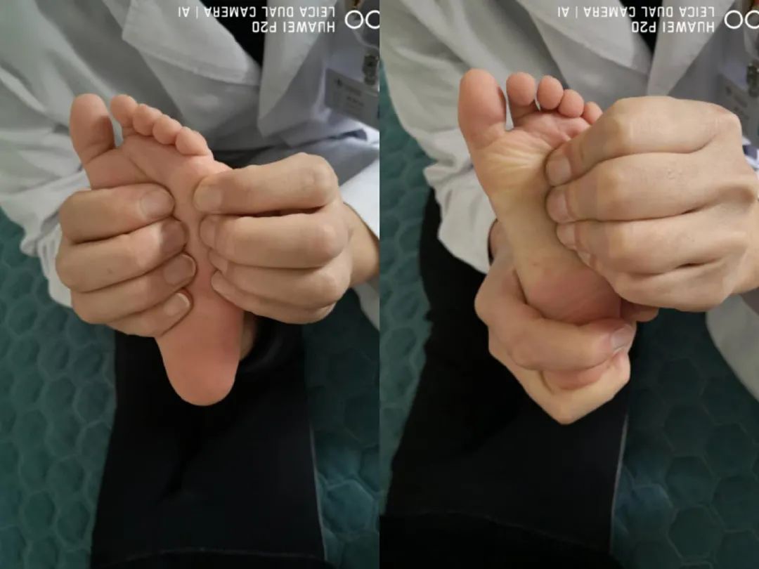 足底筋膜松动术,足底冲击疗法