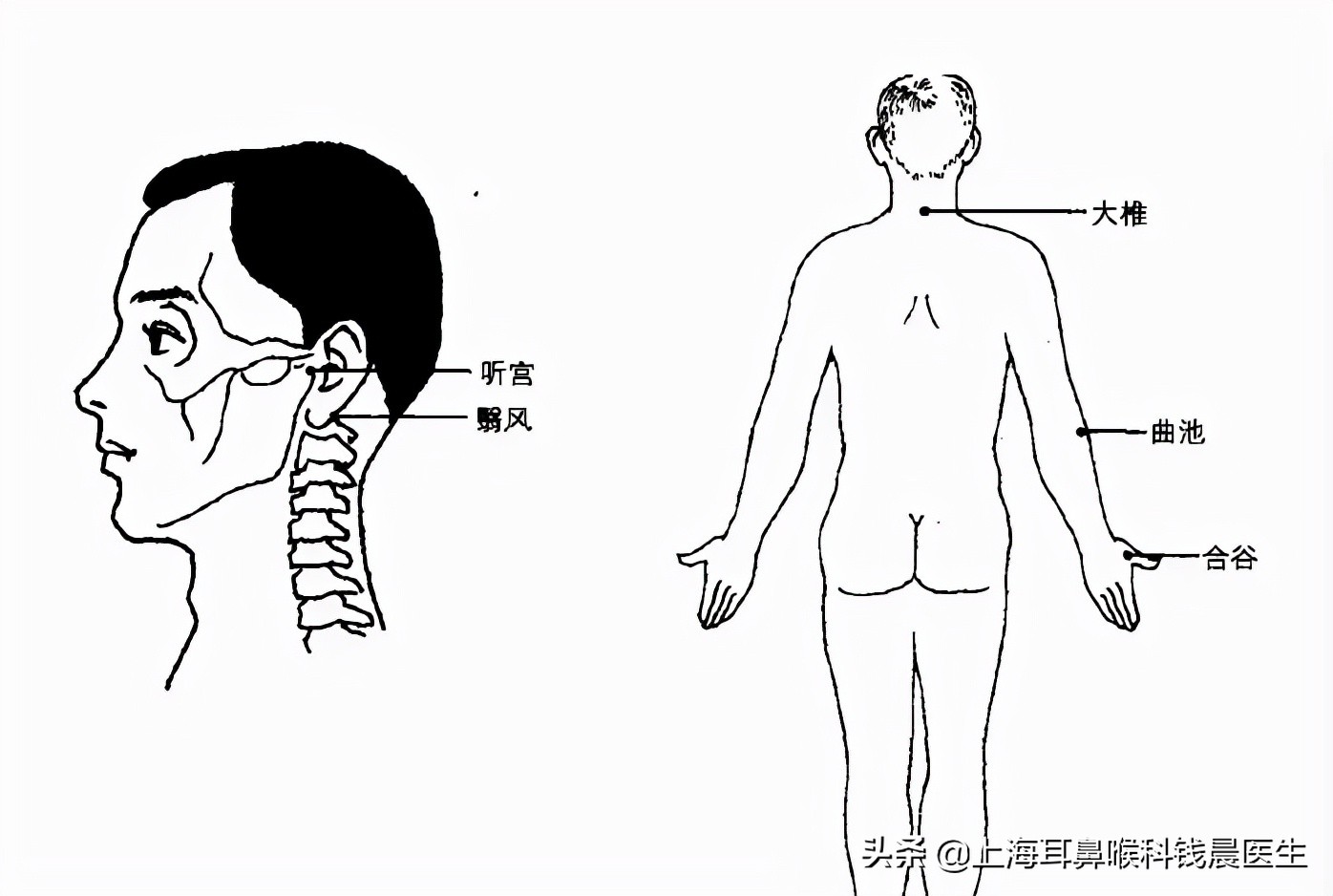 耳鸣艾灸最快的穴位,耳鸣艾灸什么穴位最见效