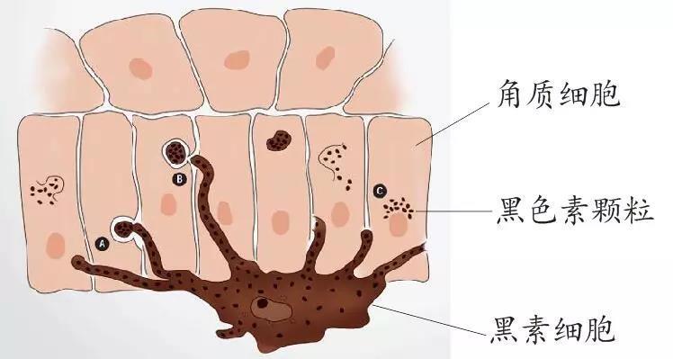 斑点的正确改善方法,皮肤暗黄斑点怎么调理