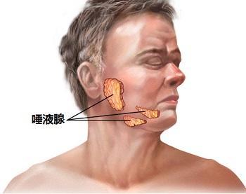 36岁女子一吃饭下巴就痛，这是什么怪病？医生：嘴巴里有个石头